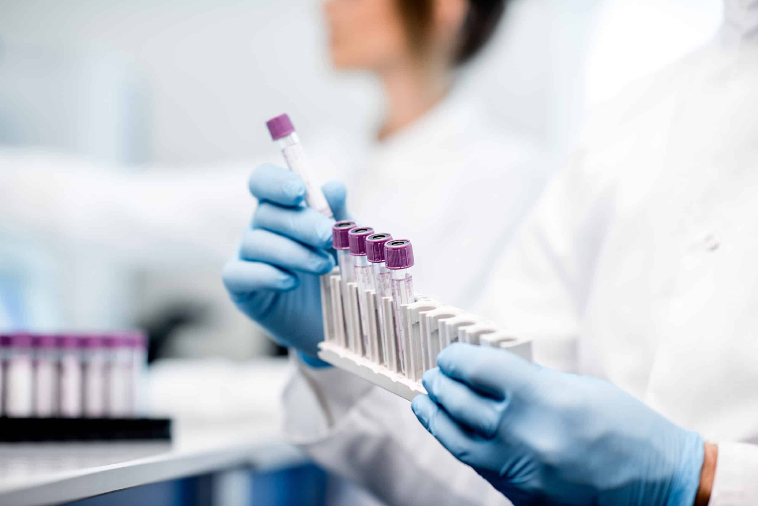woman in a gxp lab puts test tubes with purple lid into test tube holder